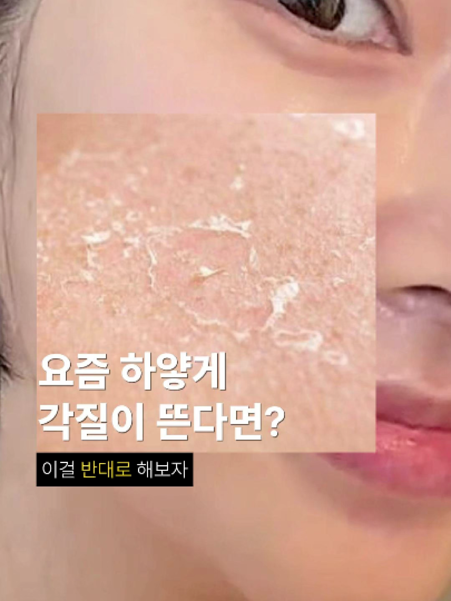 @윤블링