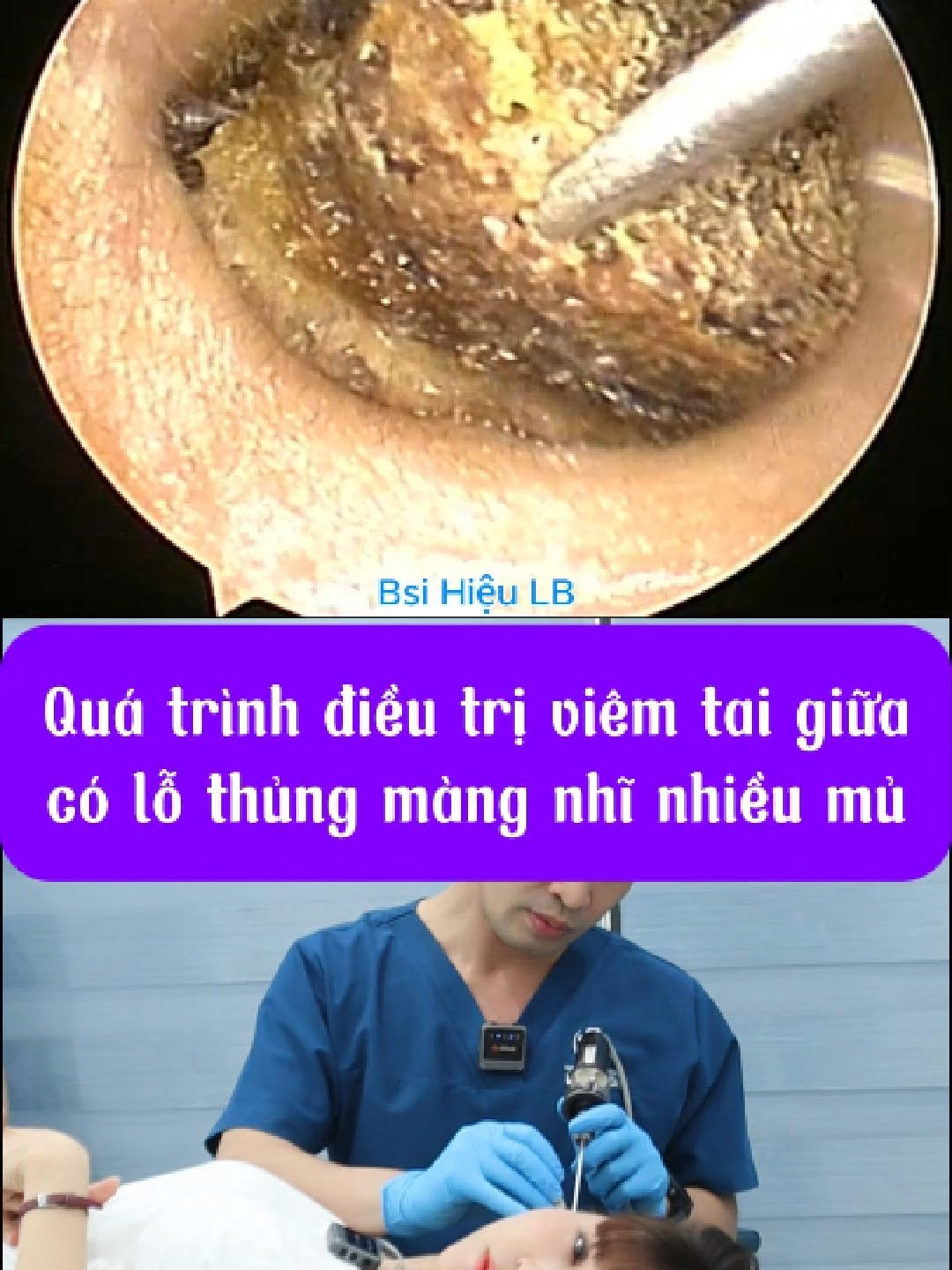 @Bs Hiệu Tai Mũi Họng Long Bi&ecirc;n