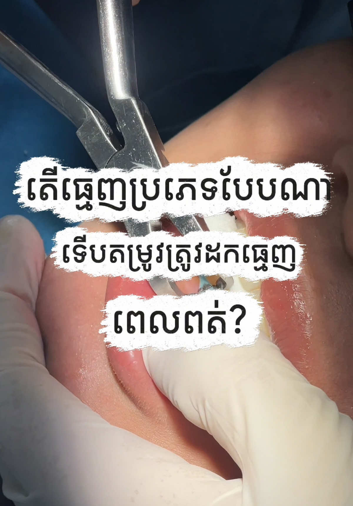 @BRIGHT SMILE DENTAL HOSPITAL