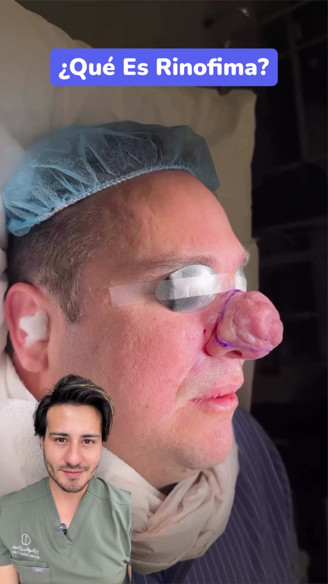 @chrisantiage