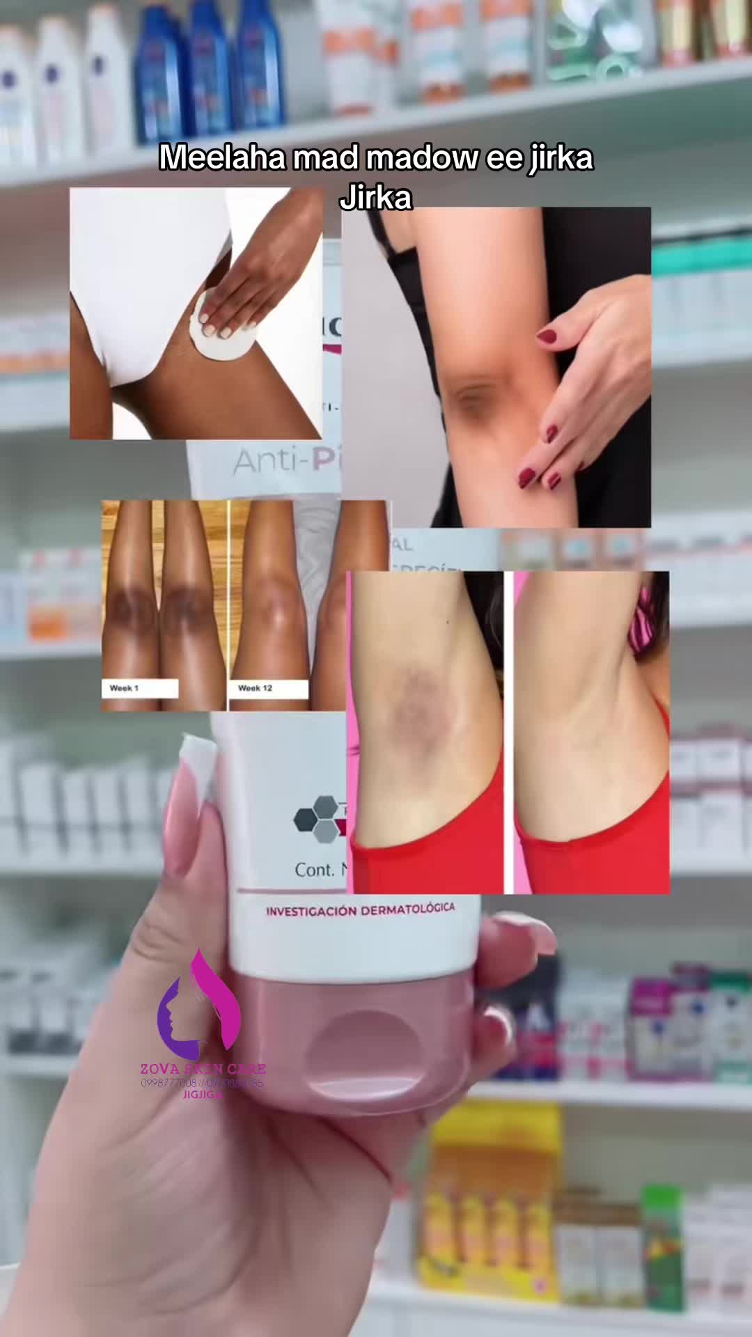 @ŽOVA ŜKIN Č̣ARE