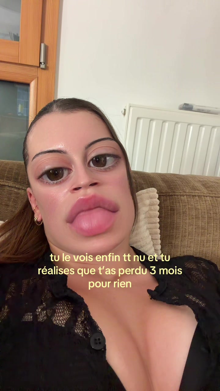 @uxanais ๐