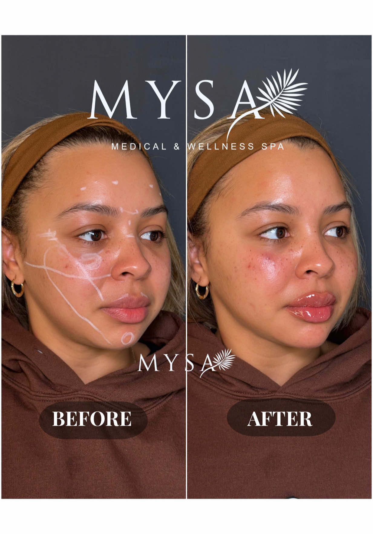 @Mysa Medical & Wellness Spa