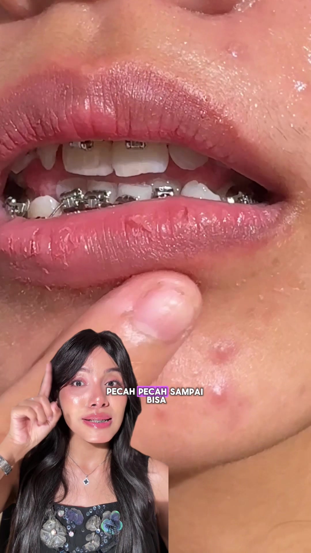 @Deenish_