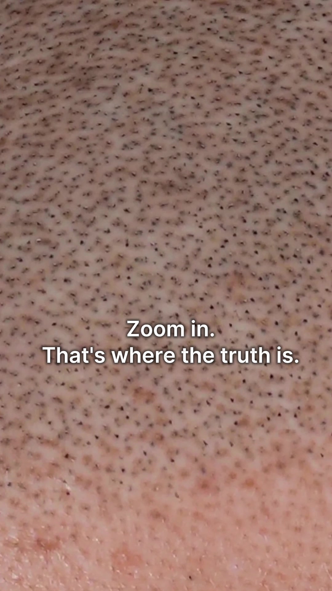 @Enhanced Scalp