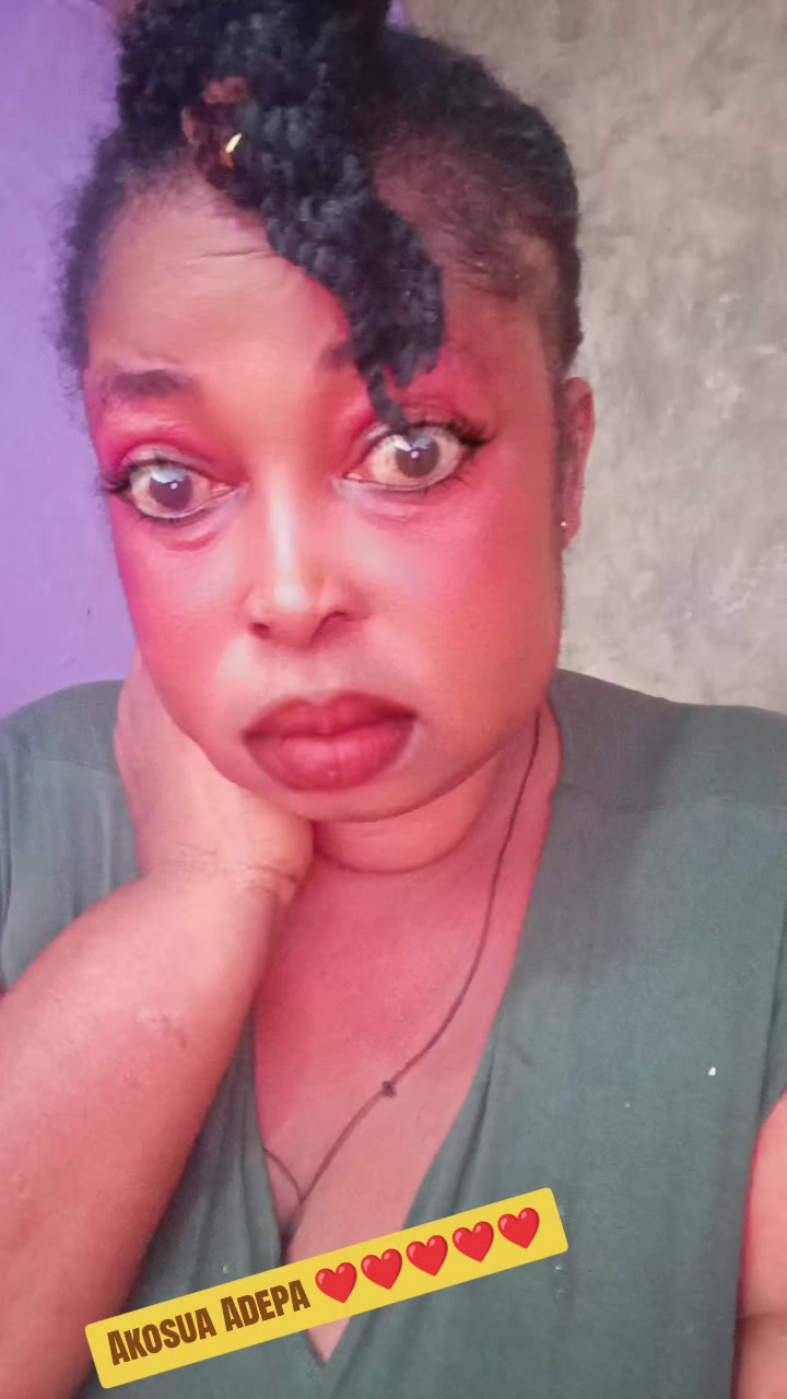 @Obaapa hemaa