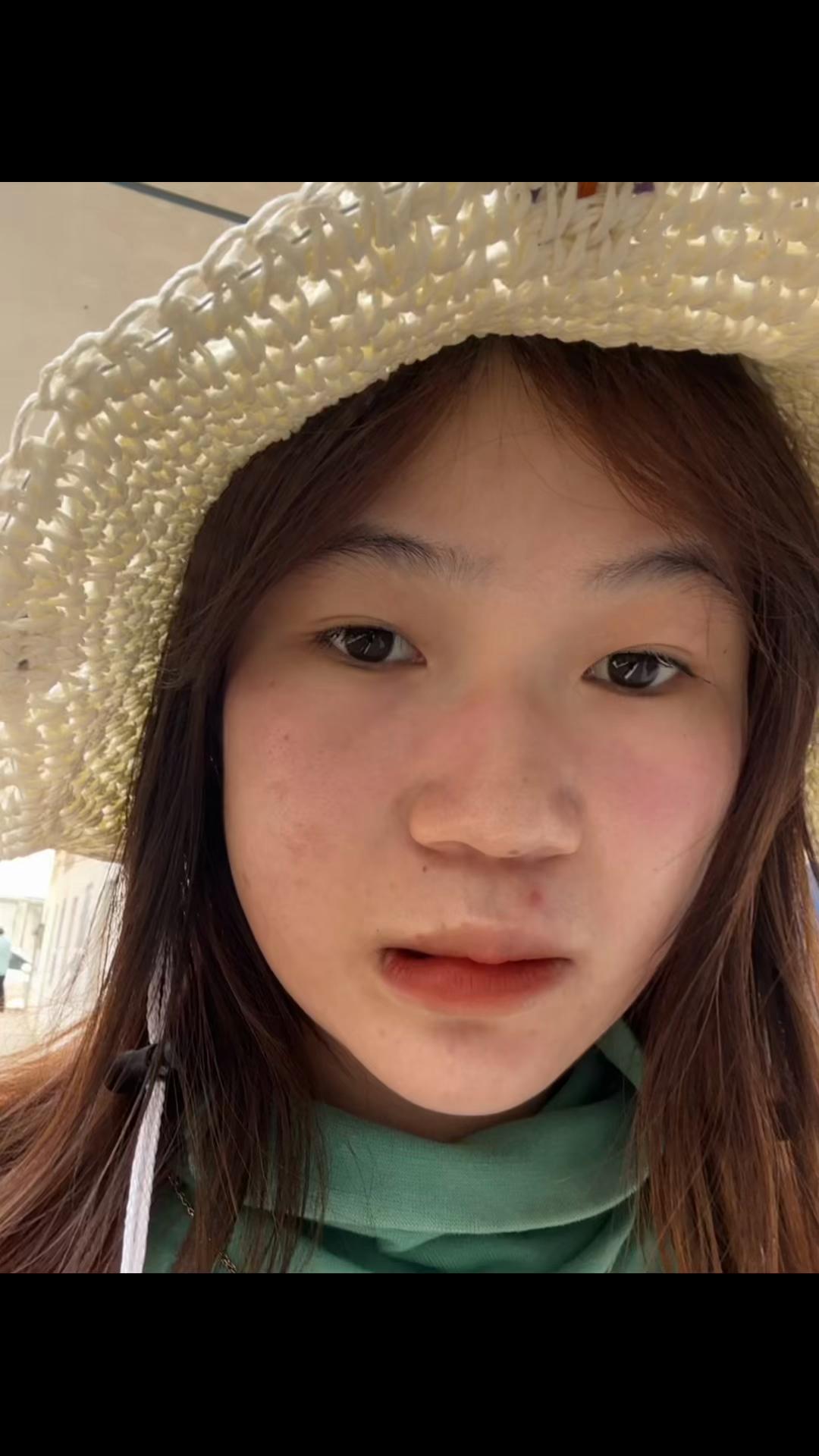 @Ach ko๐