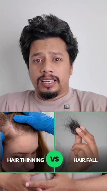 @NAZID HAIR TRANSPLANT