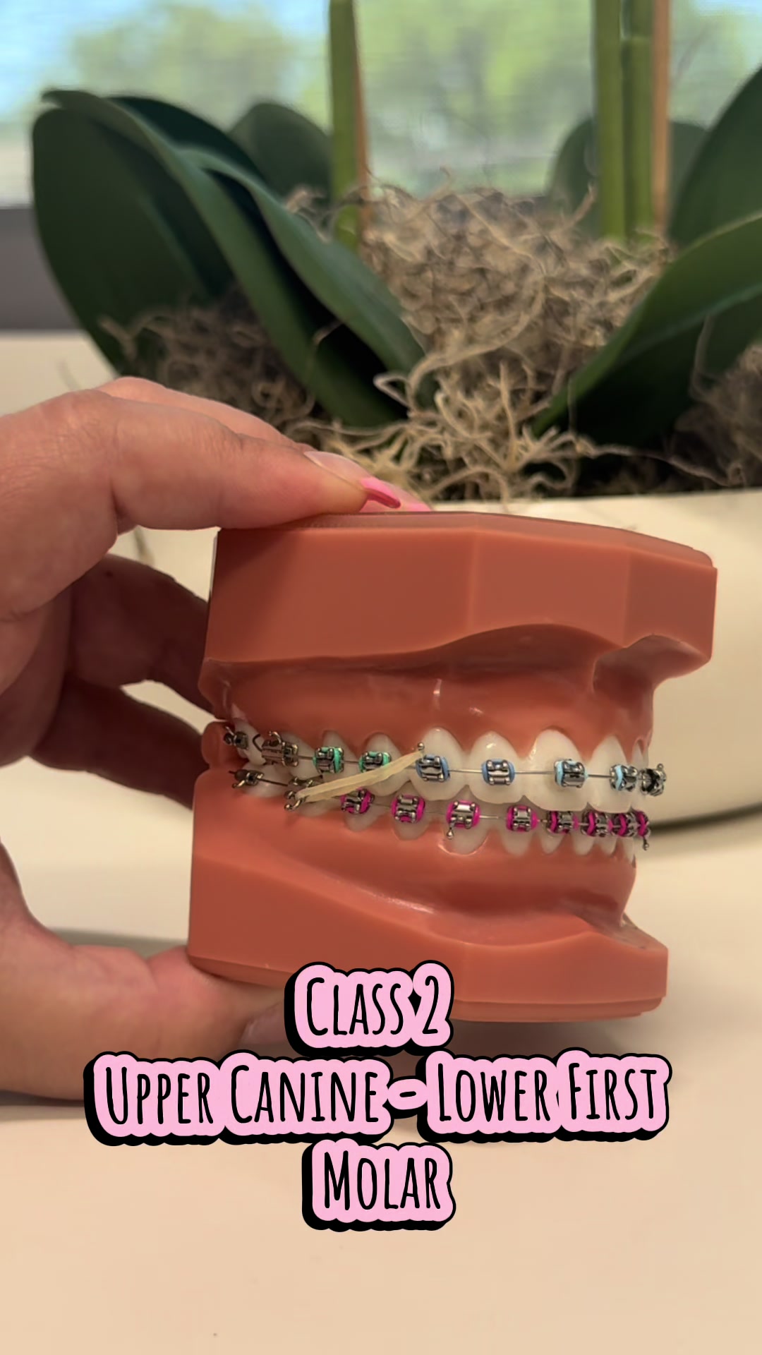 @Hannon Orthodontics