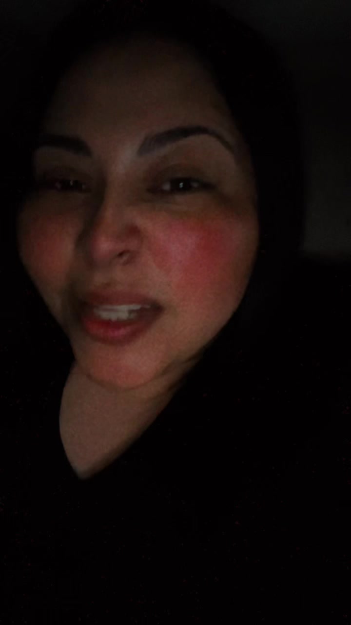 @iselarana2