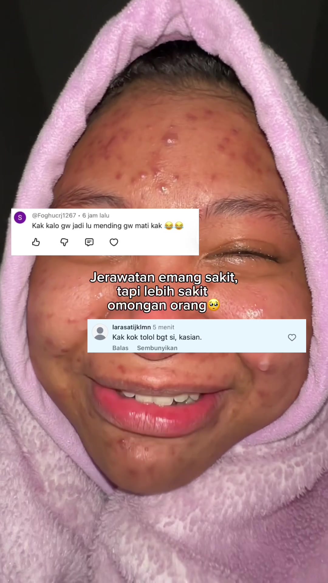 @MBAK CUNGCAT BAYI