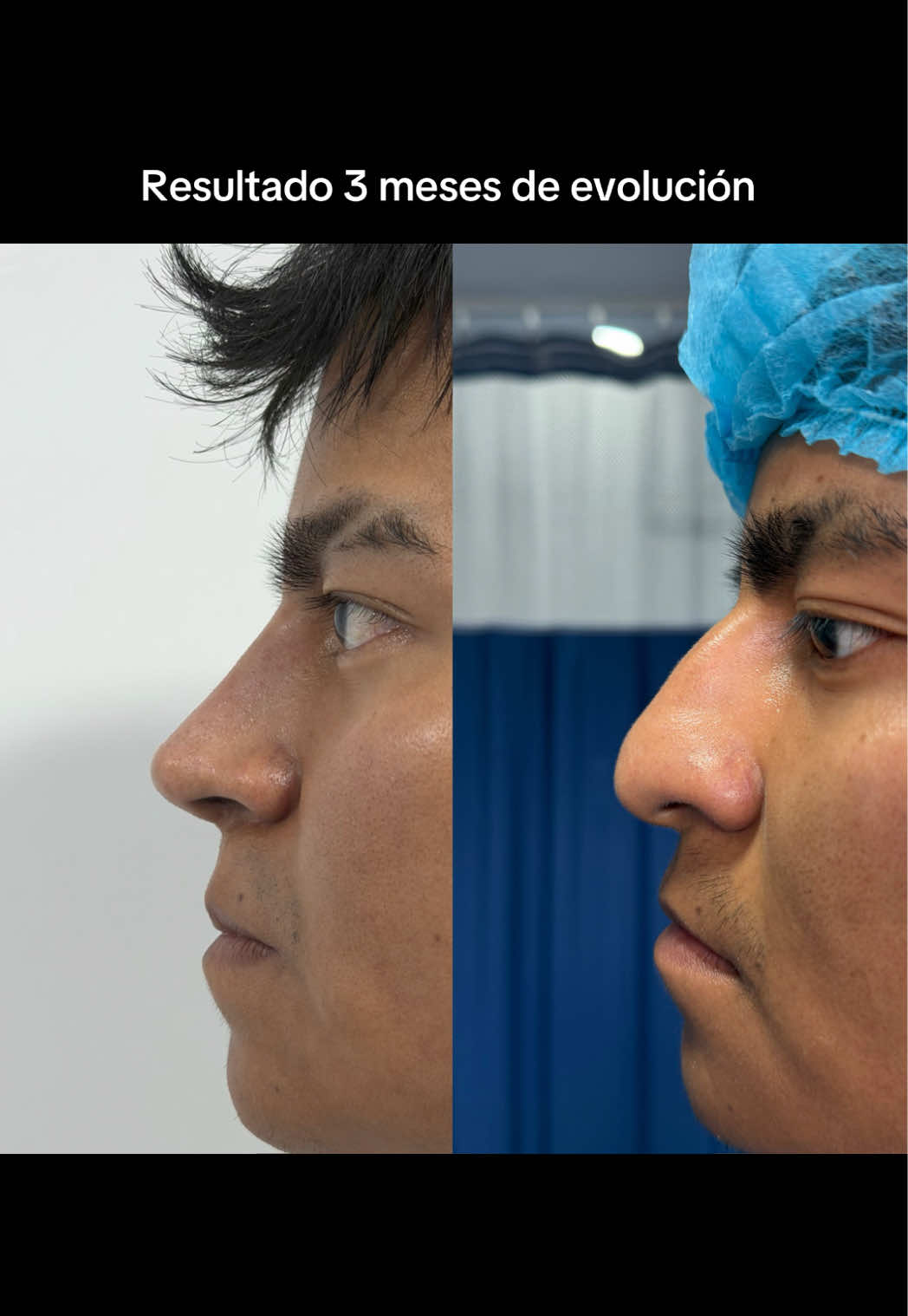 @Dr. Luis Vargas
