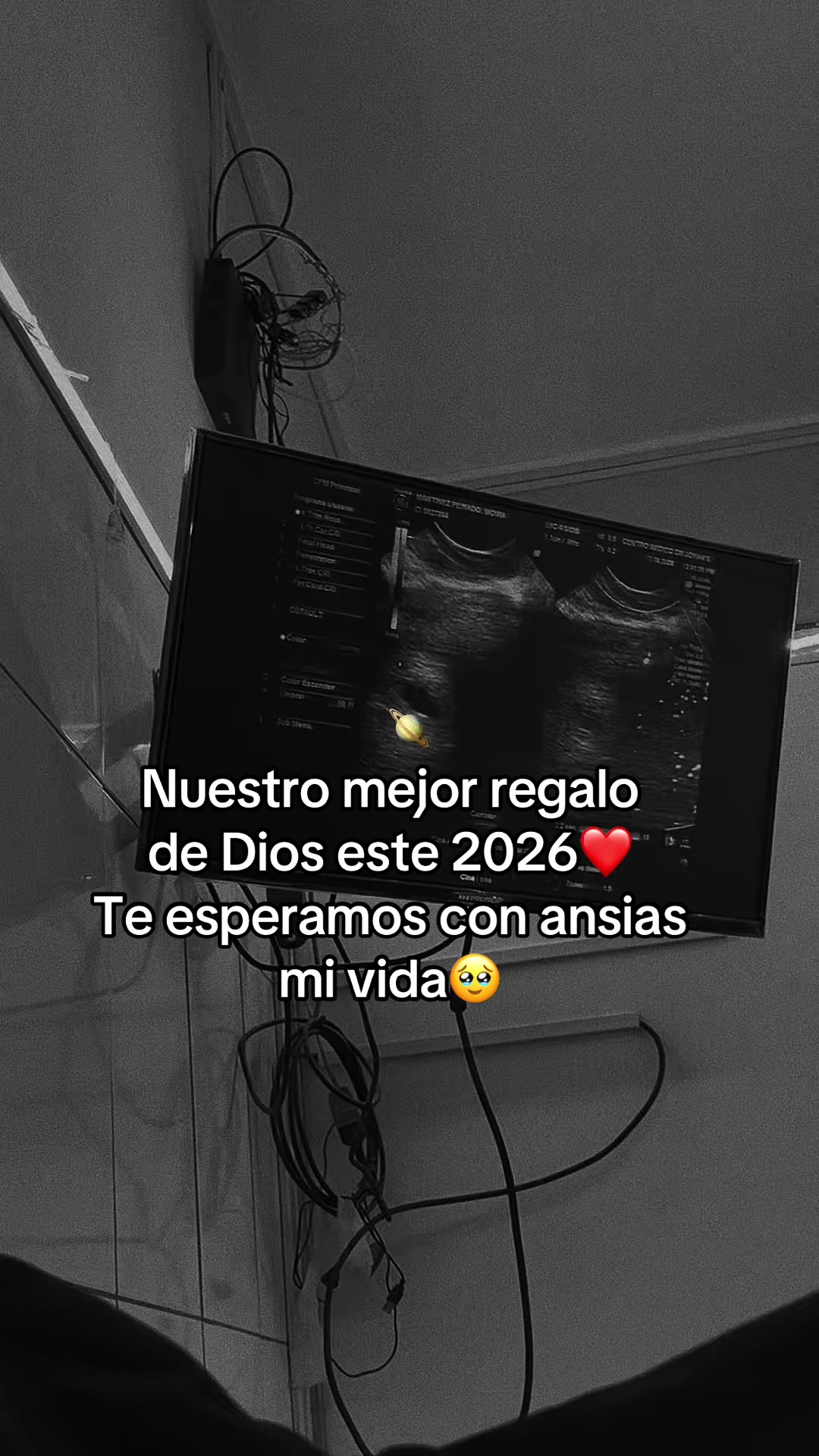 @Yosoymoira