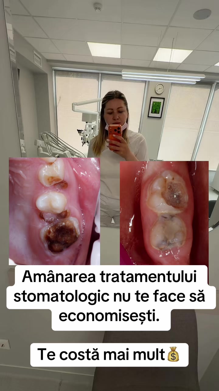 @Stomatolog Snejana Carabulea🦷