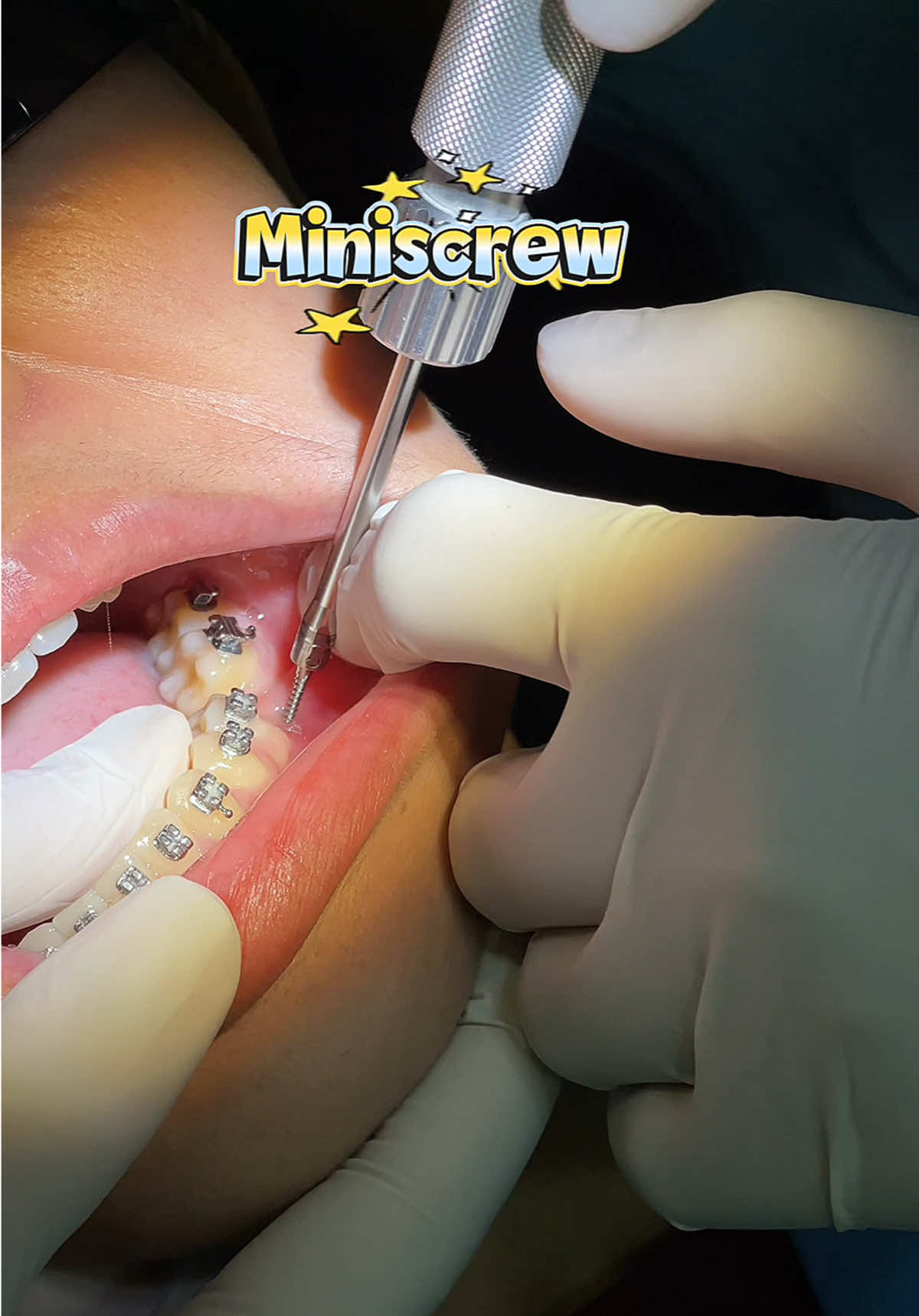@BRIGHT SMILE DENTAL HOSPITAL