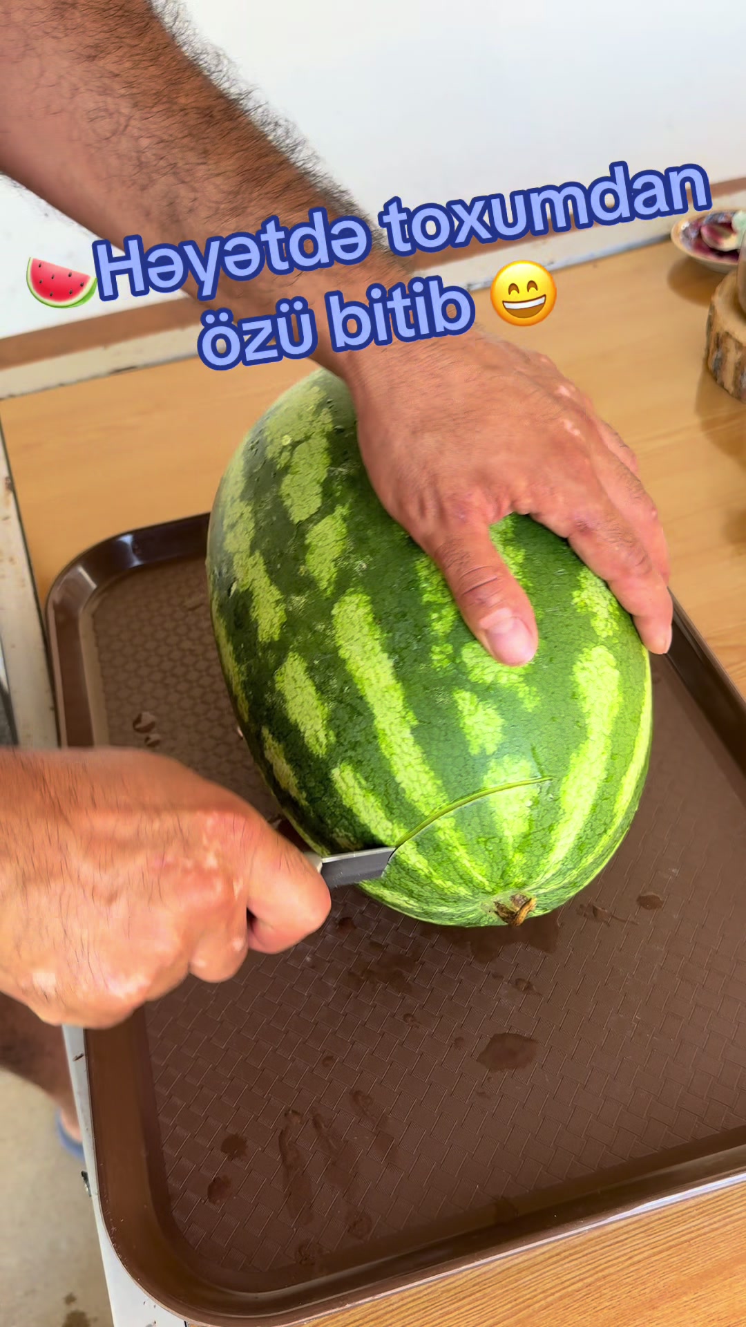 @&Uuml;mumi Cərrah Rəşad Əkbərli