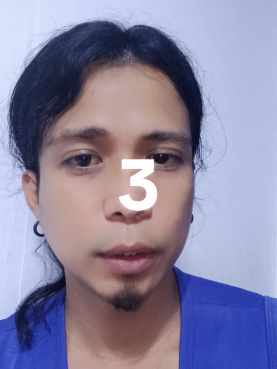 @RenzMikel