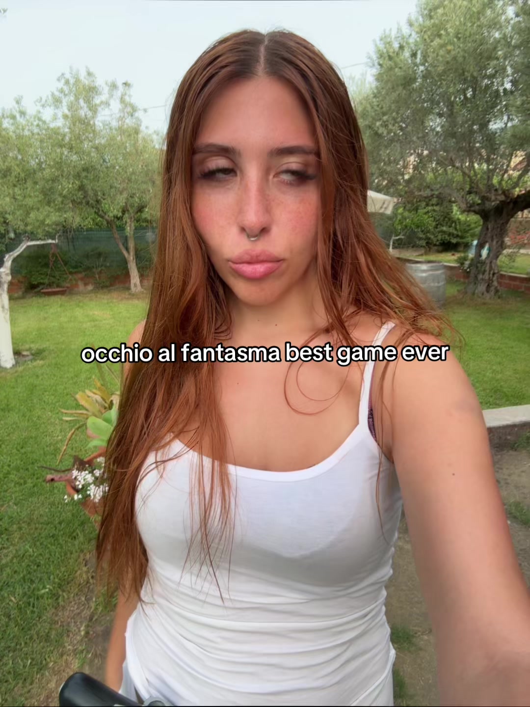 @ketoprophede