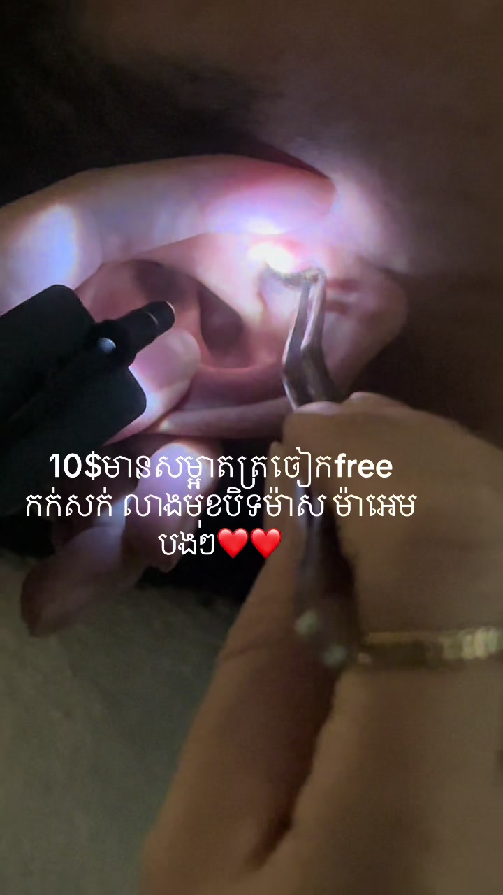 @ហាង សំអាតត្រចៀក 081 674455