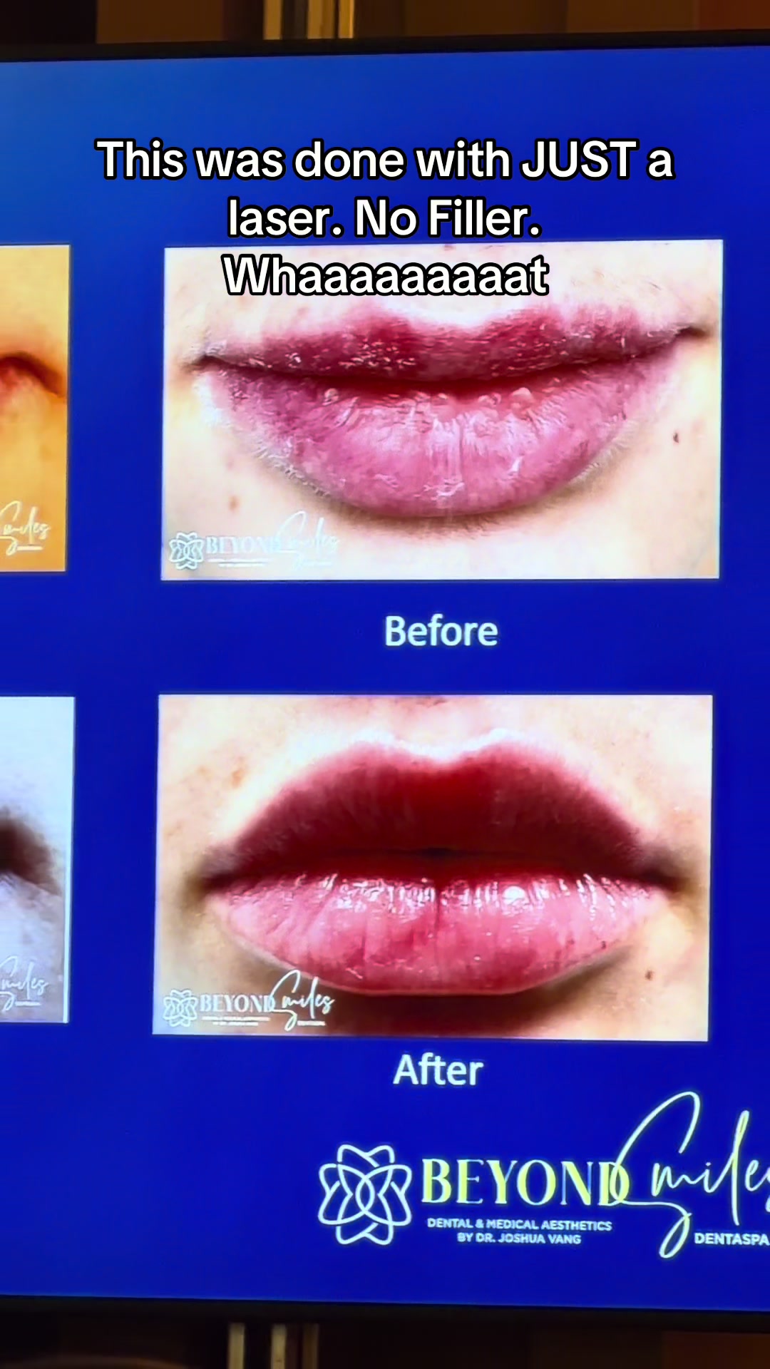 @Dr Cohen Saves Teeth | DDS🦷