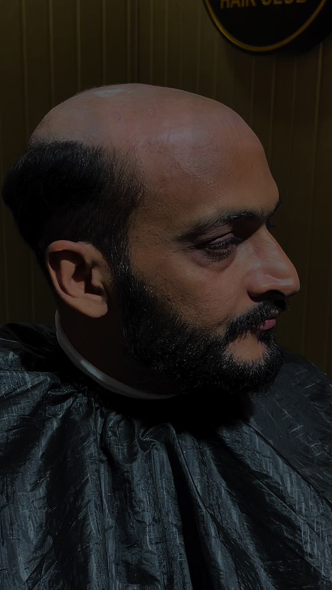 @Capital Hair Club RWP/ISB