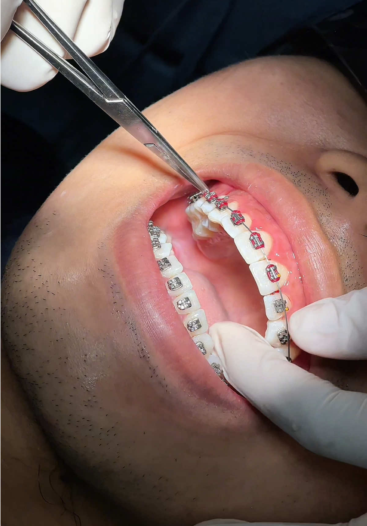 @BRIGHT SMILE DENTAL HOSPITAL