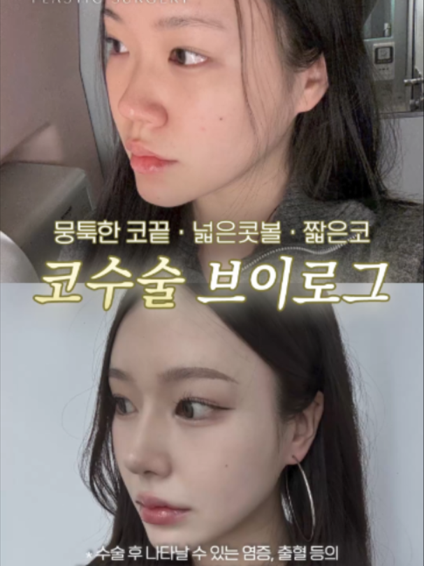 @리셋성형외과