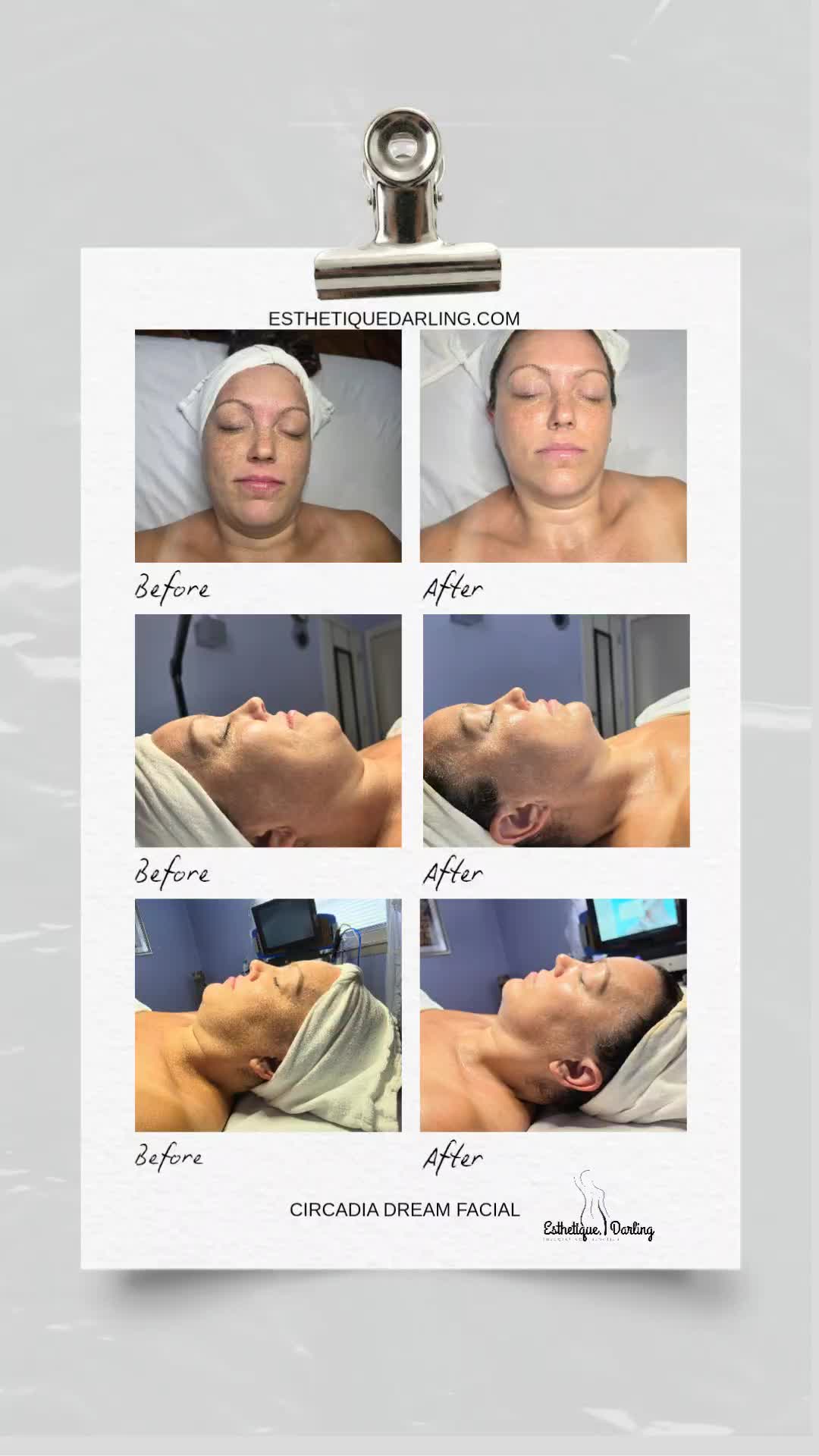 @Esthetique, Darling LLC