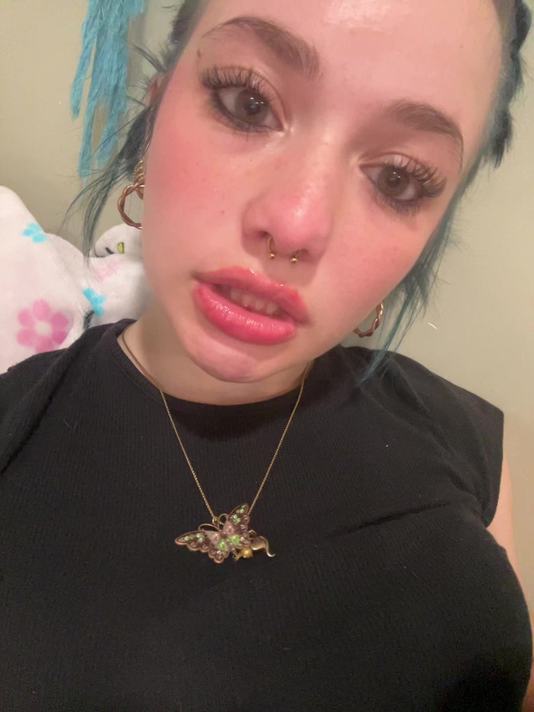 @🦄