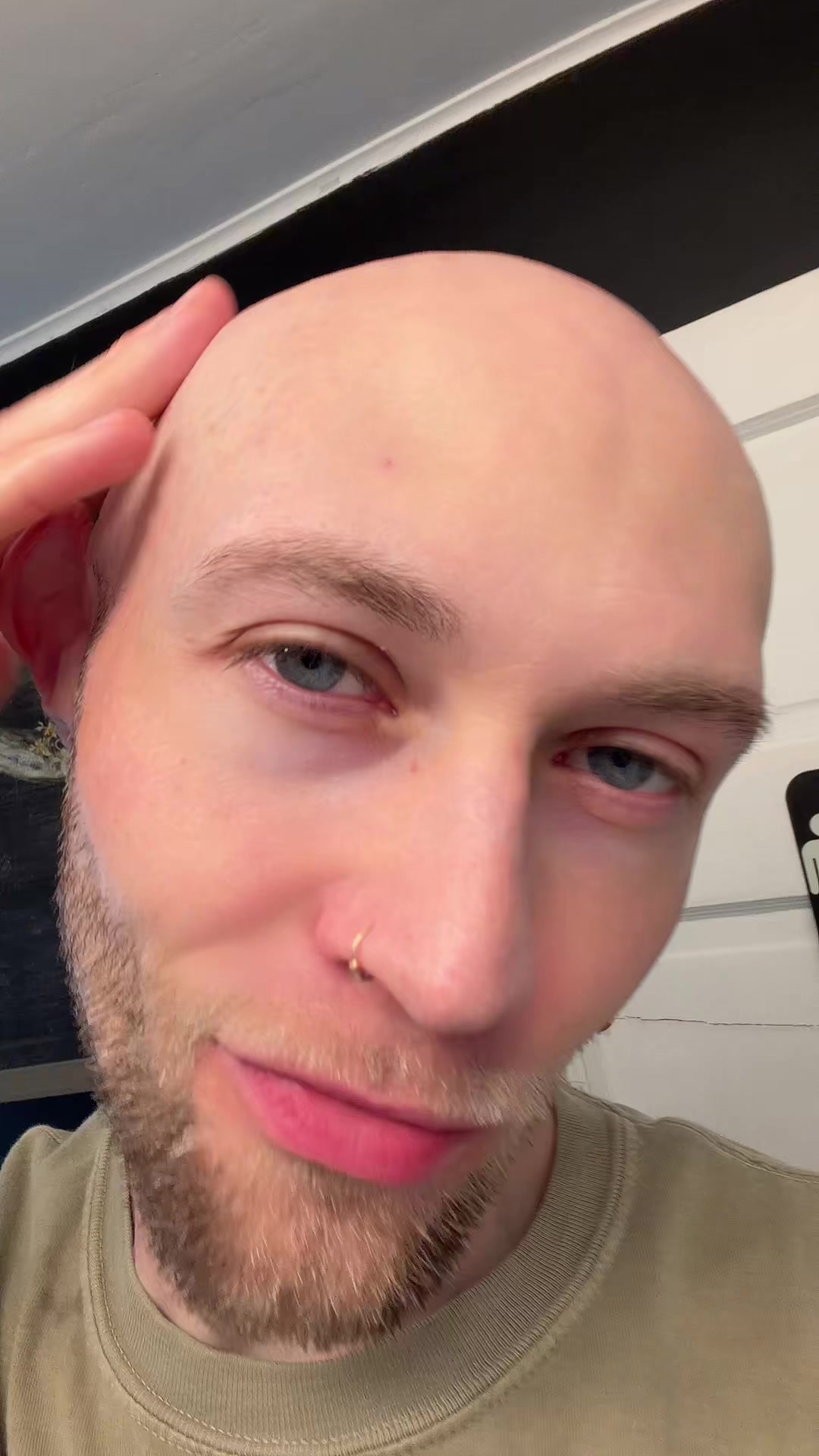 @Follicular