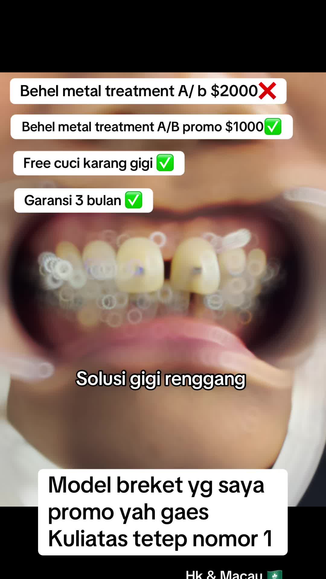 @mbak-Paijem