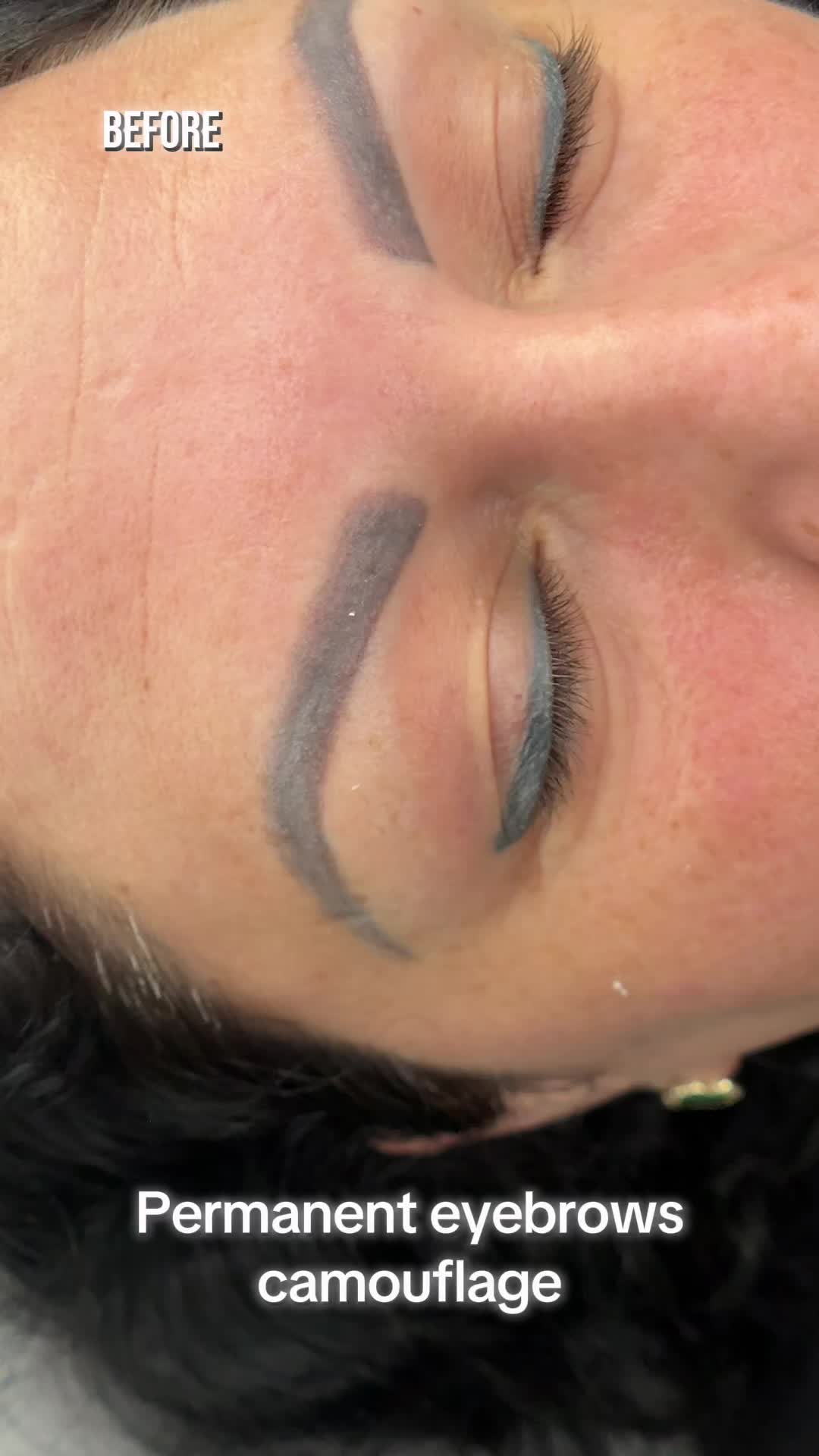 @Permanent Makeup & Removal