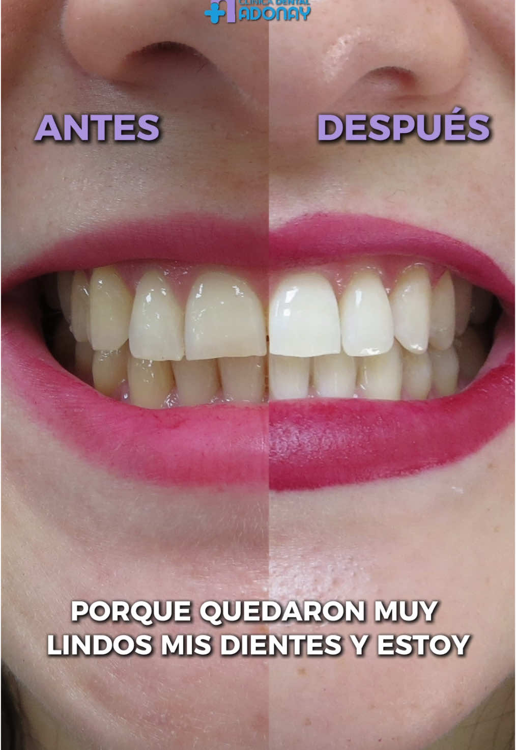 @Cl&iacute;nica Dental Adonay