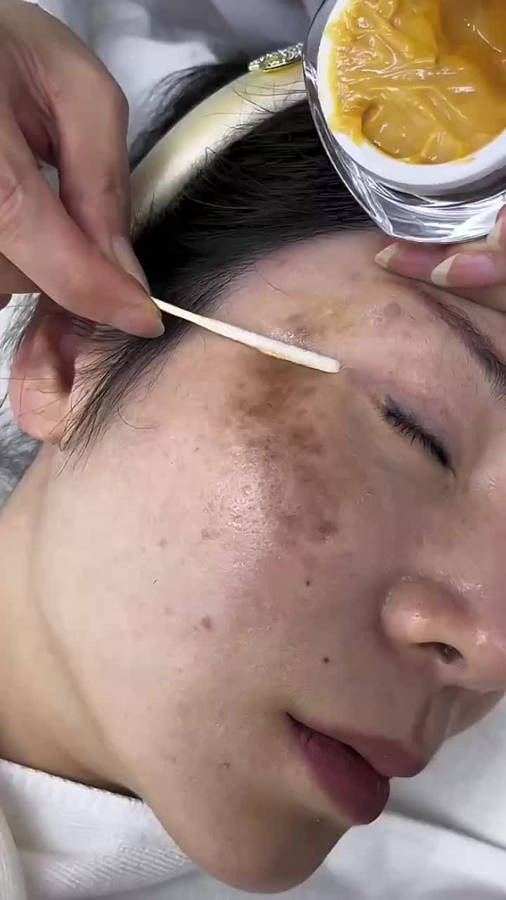 @Skincare Queen👑