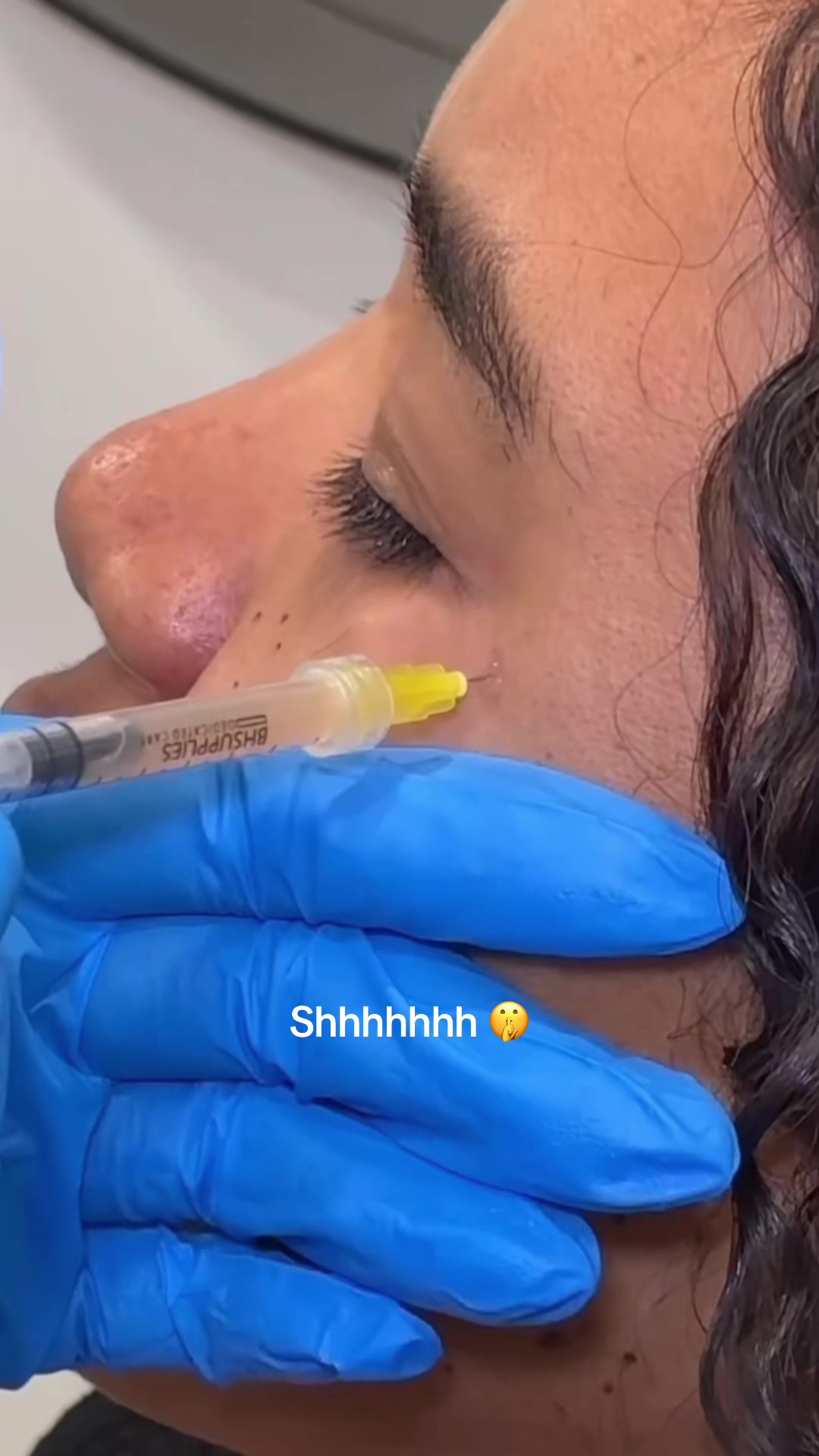 @Botox Filler Skin Los Angeles