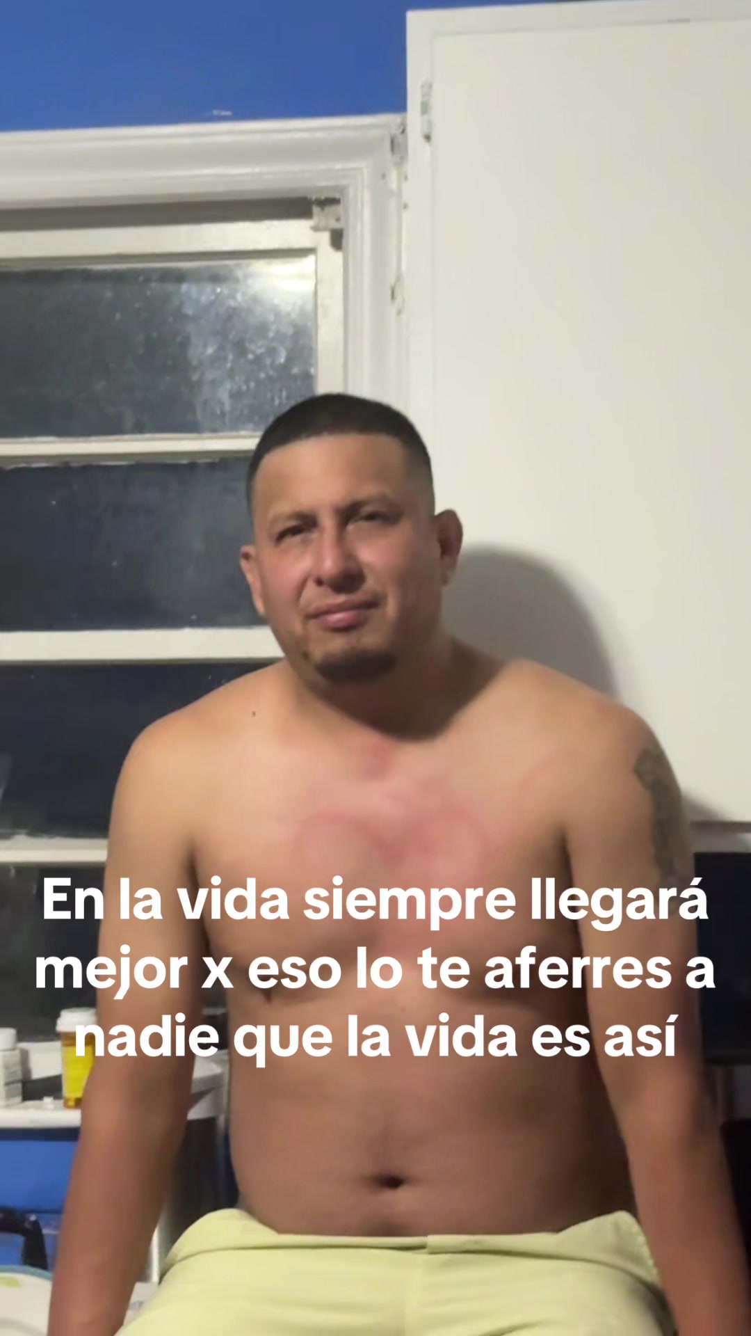 @Catalella