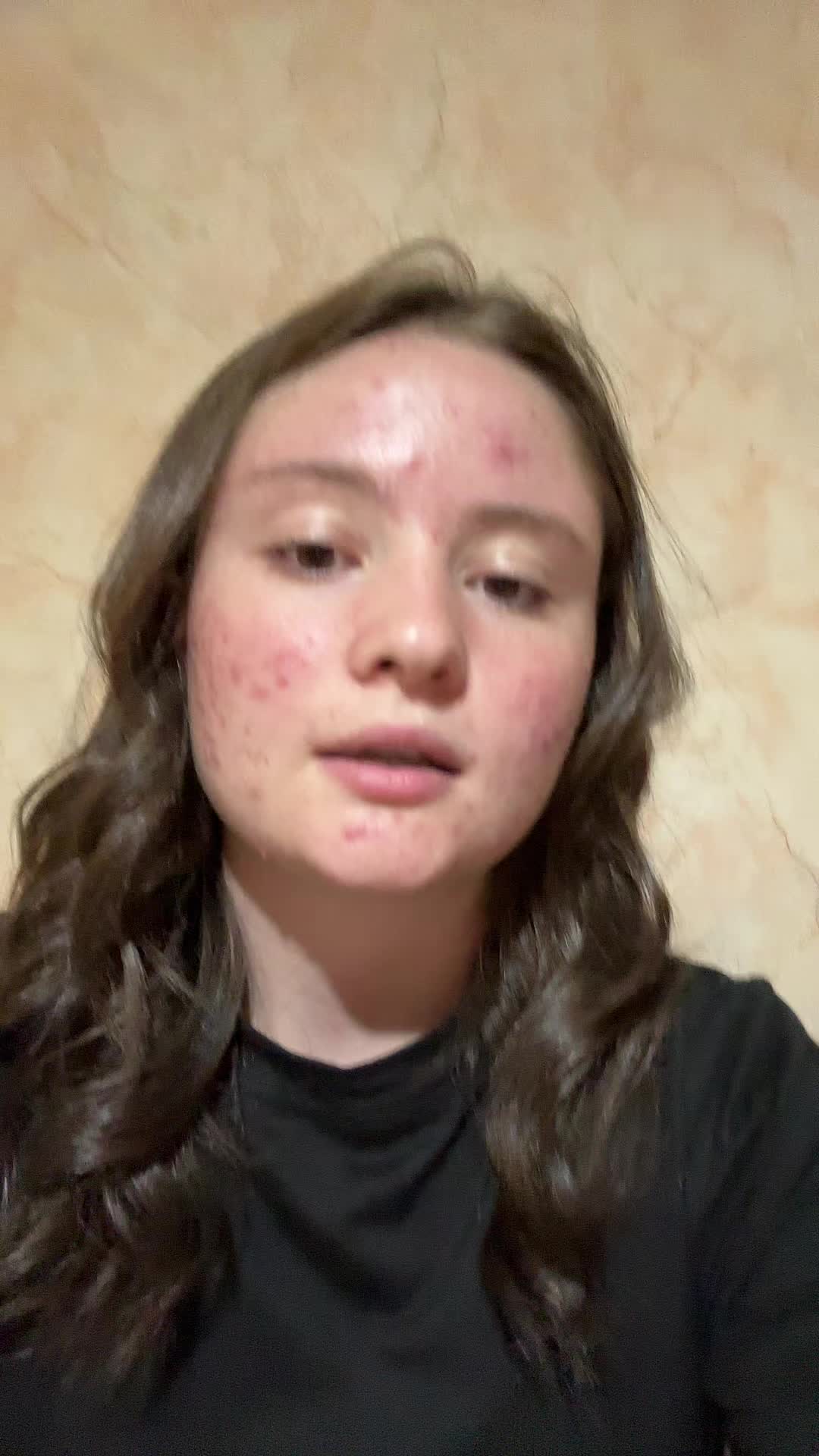 @DOINAAAA🤯