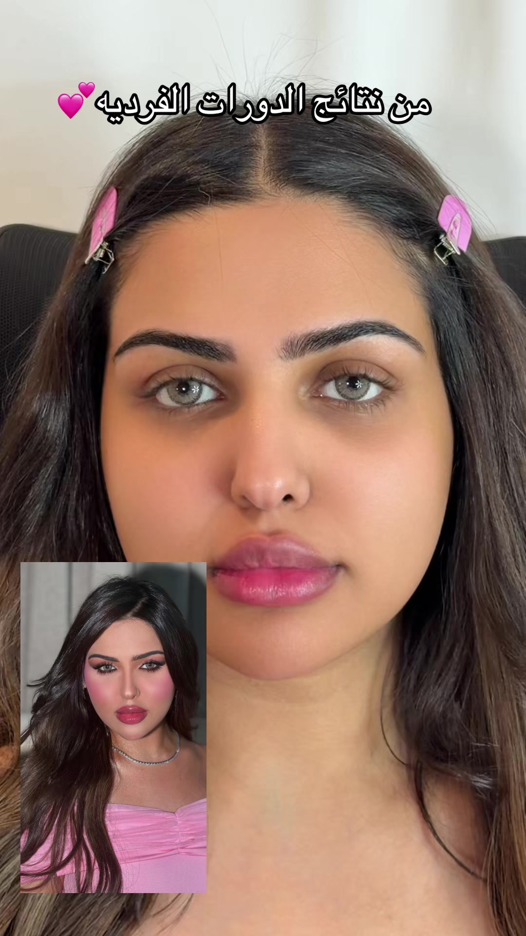 @Amina Aldossari