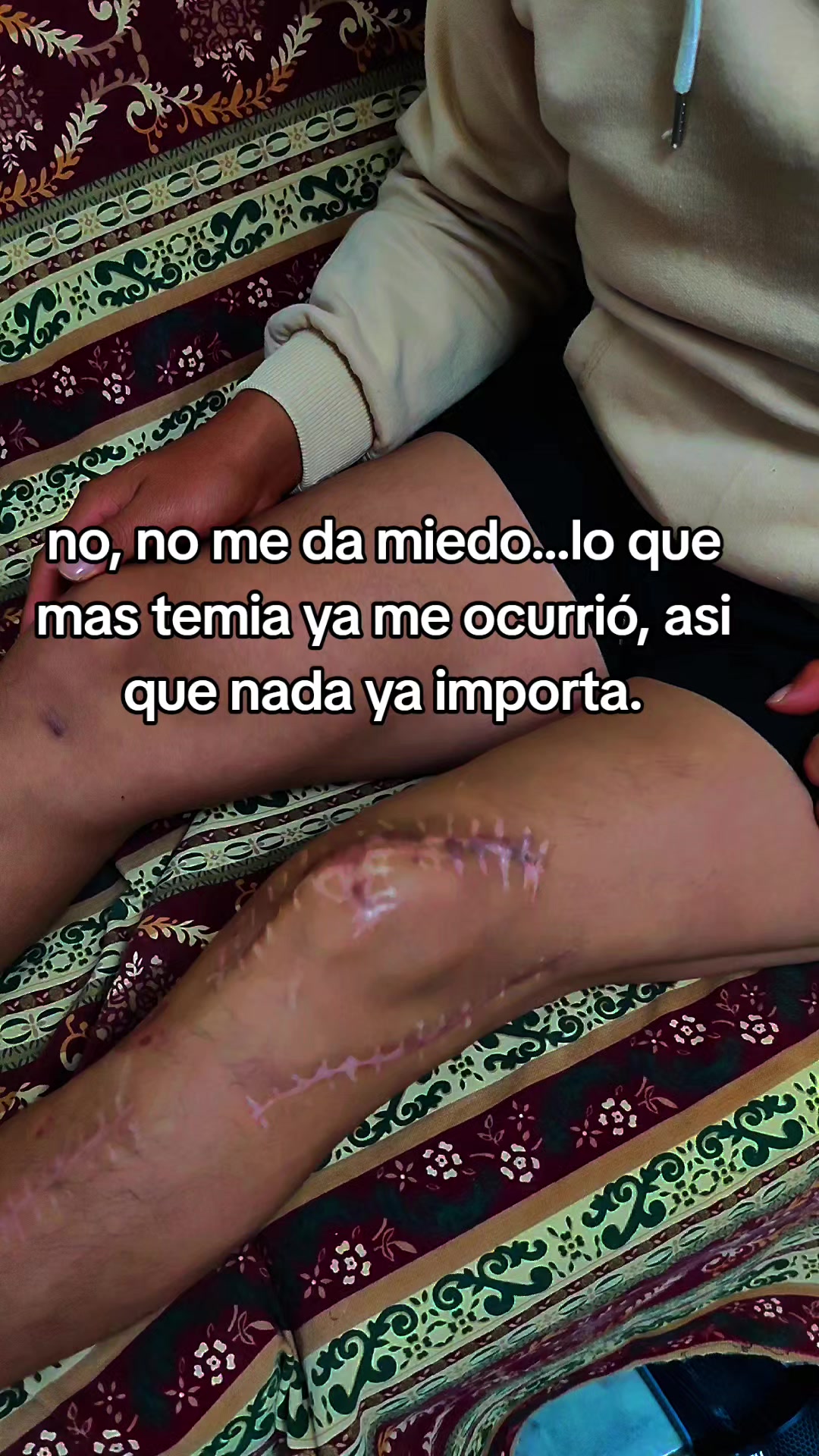@IKO
