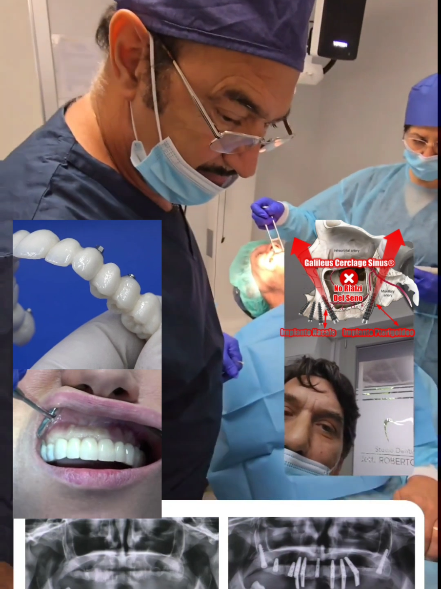 @Implantologiaprezzi