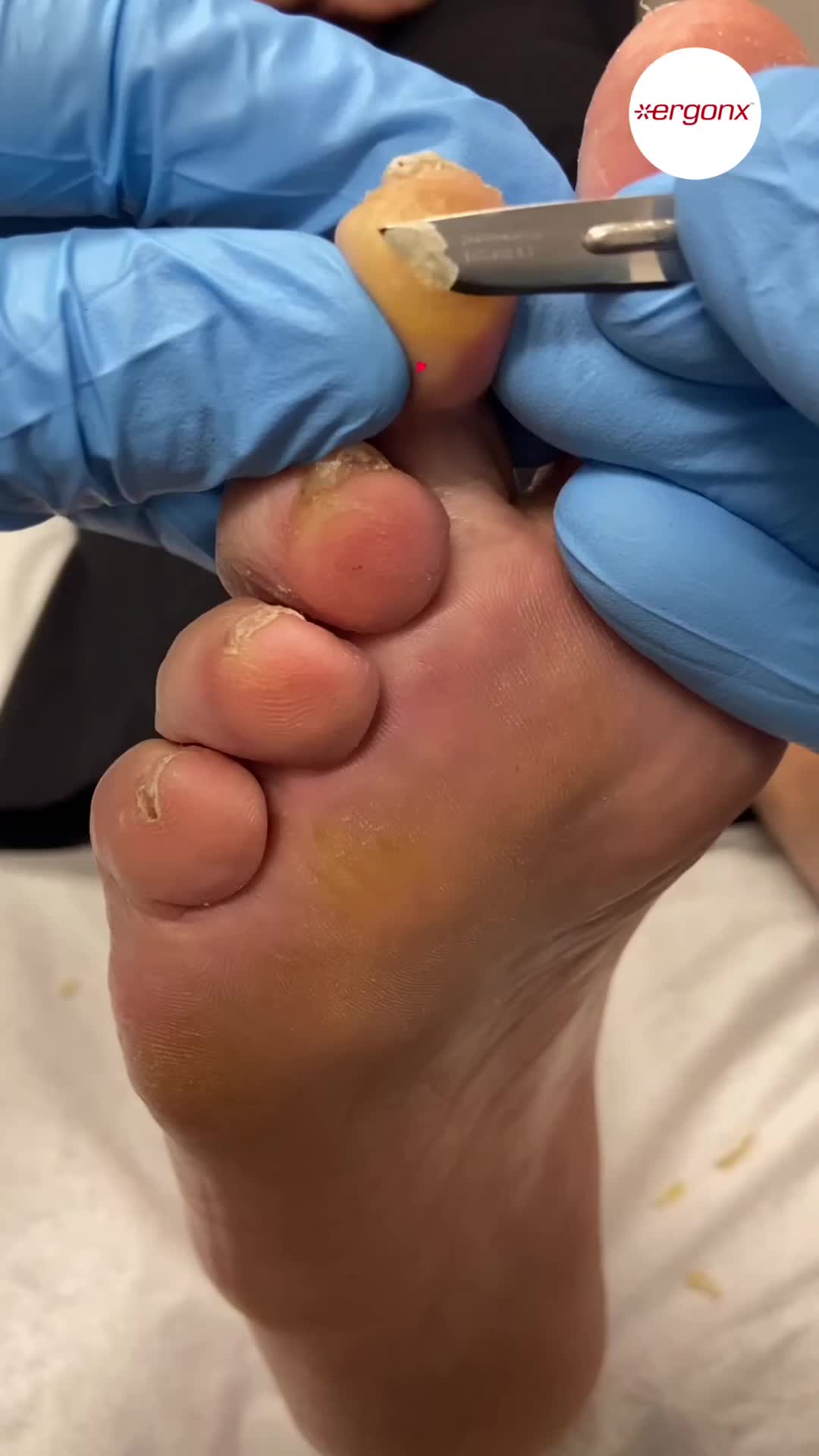 @ergonx
