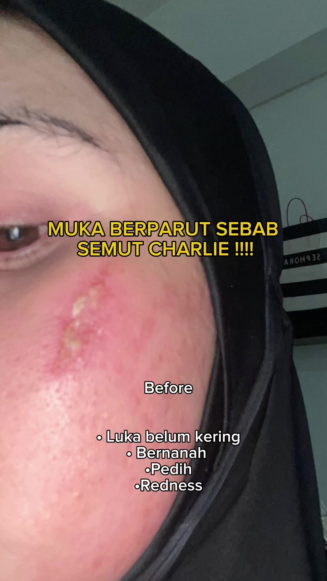 @aini.asyiqinn