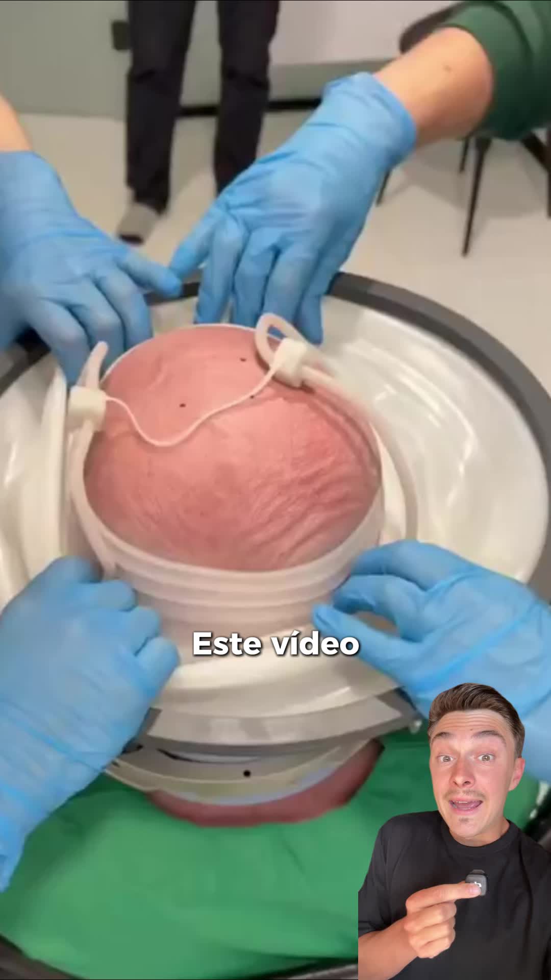 @DietAlvaro