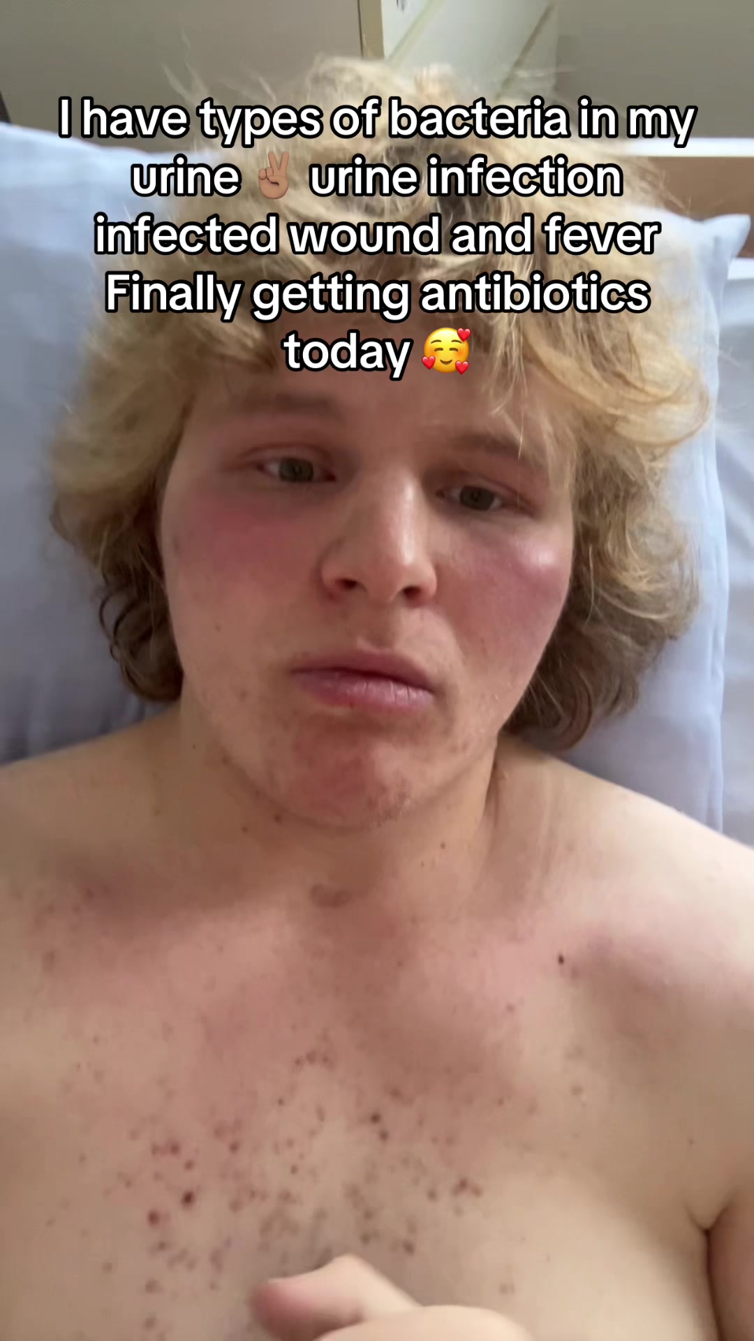 @#1 paralyzed Mogger