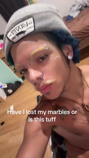 @Alt prince 🧑🏽🦽➡️