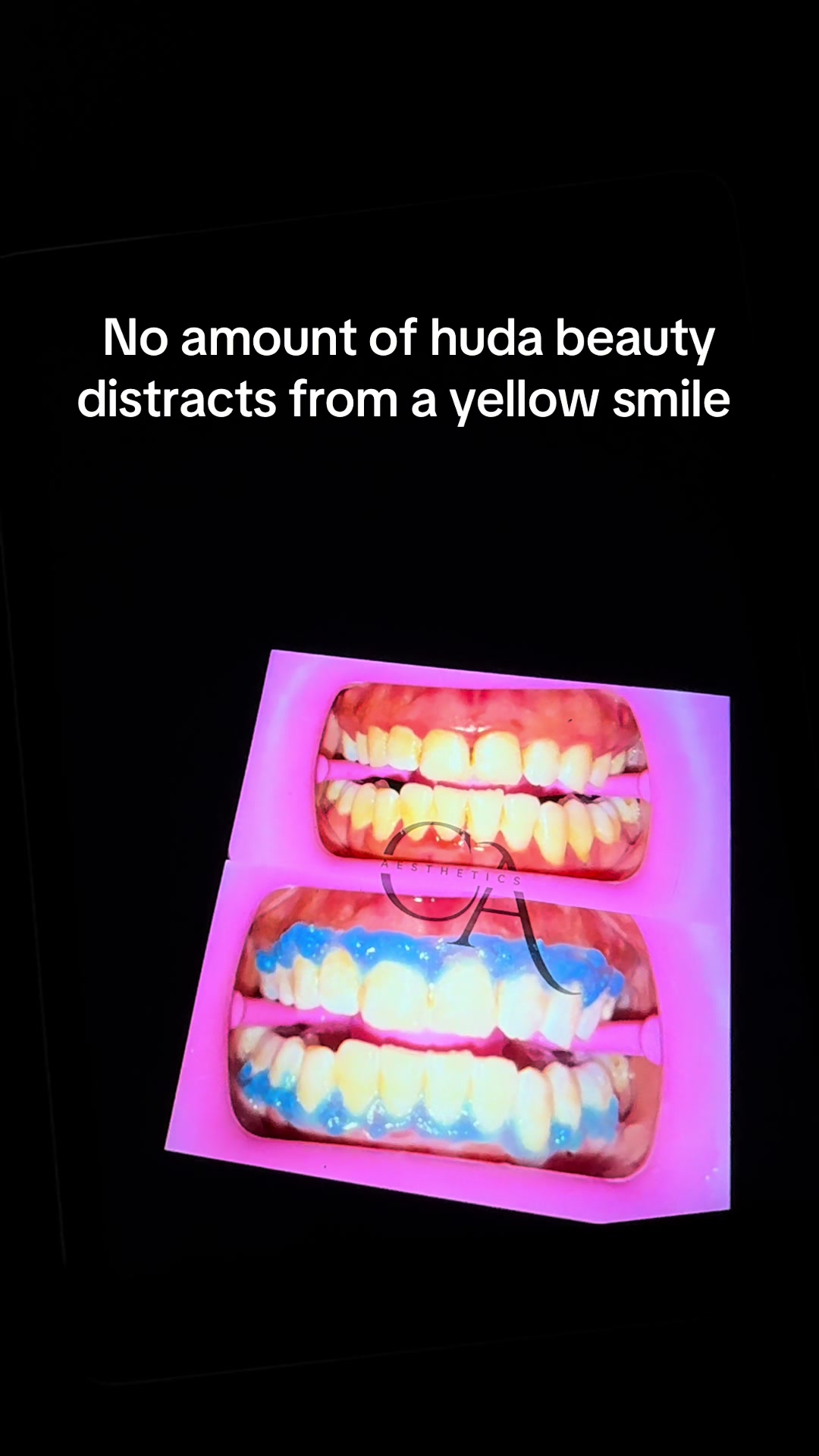 @Halal Teeth Whitening London