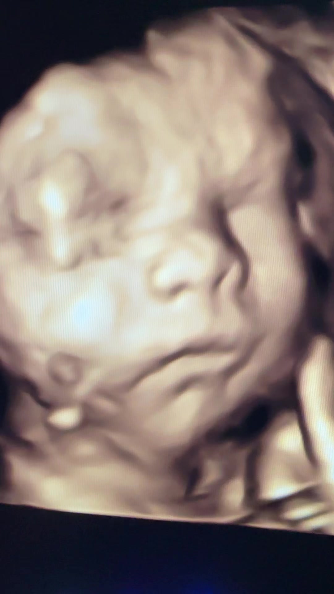 @WindowToTheWomb Ellesmere Port