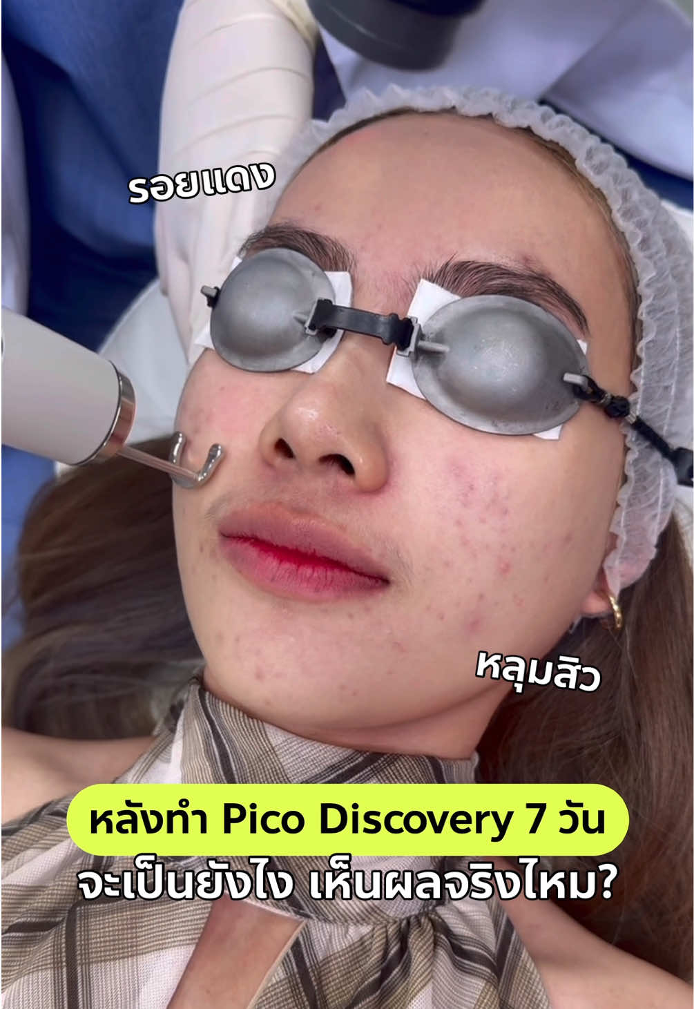 @Standard Skin clinic