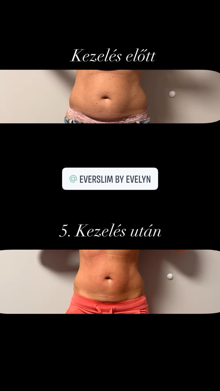 @EverSlim by Evelyn🌸
