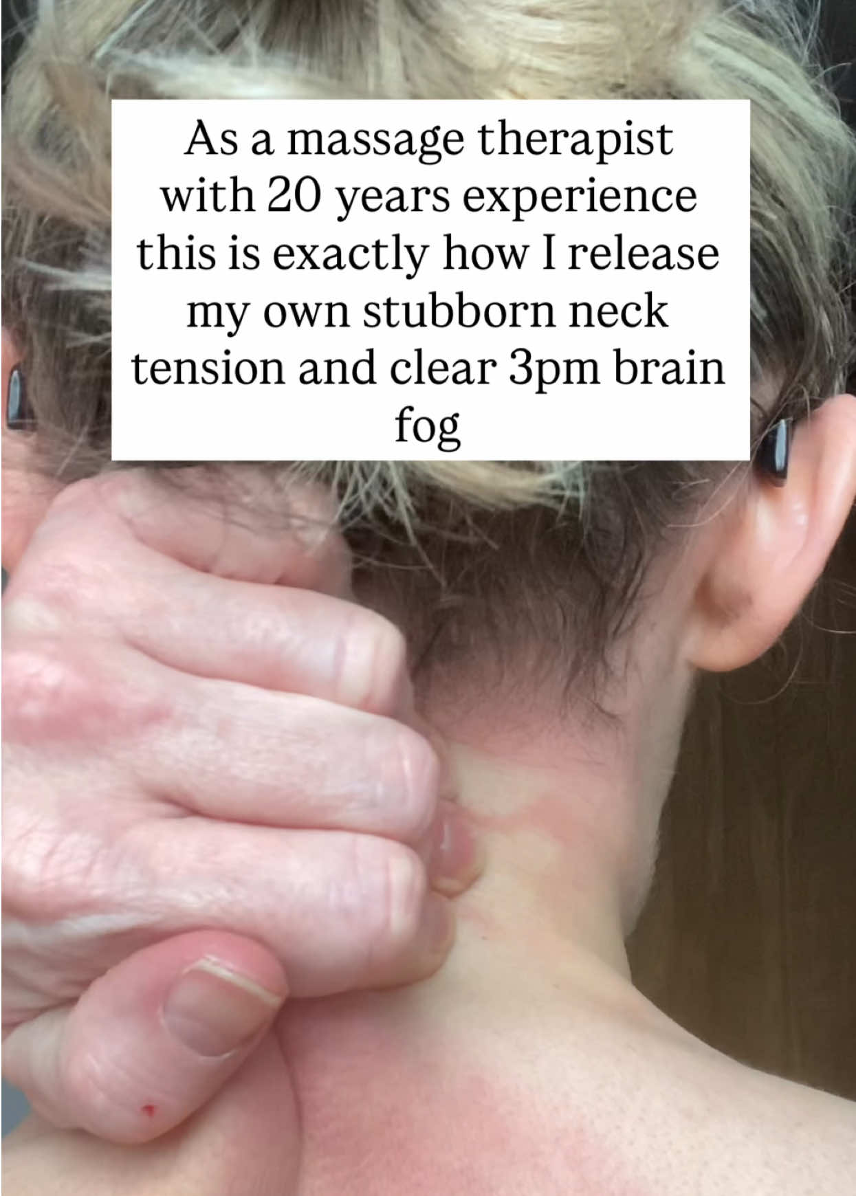 @Alison &ndash; Neck Tension Help